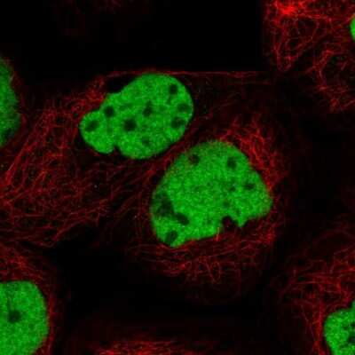 Immunocytochemistry/ Immunofluorescence: U2AF35 Antibody [NBP1-92553]