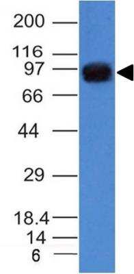 Western Blot: UACA Antibody (AE-5) [NBP3-11313]