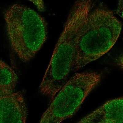 Immunocytochemistry/ Immunofluorescence: UACA Antibody [NBP2-58742]
