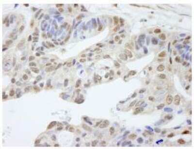 Immunohistochemistry-Paraffin: UACA Antibody [NB100-61622]