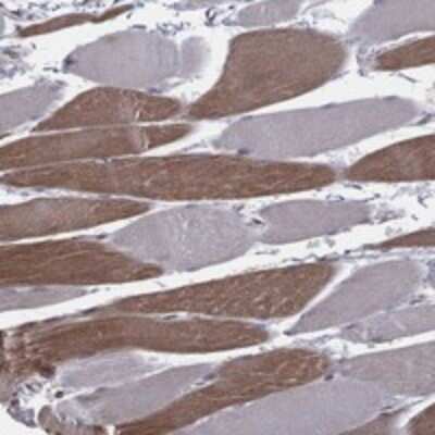 Immunohistochemistry-Paraffin: UACA Antibody [NBP3-17954]