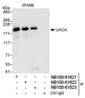 Western Blot: UACA Antibody [NB100-61622]