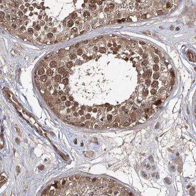 Immunohistochemistry-Paraffin: UAF1/WDR48 Antibody [NBP1-81404]