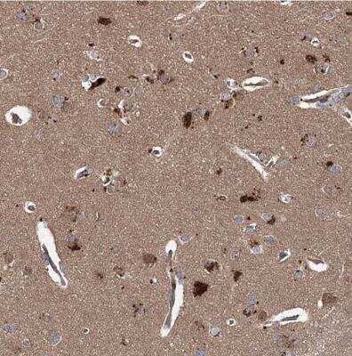 Immunohistochemistry-Paraffin: UAF1/WDR48 Antibody [NBP1-81404]