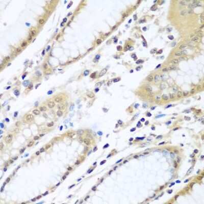 Immunohistochemistry-Paraffin: UAF1/WDR48 Antibody - BSA Free [NBP2-95220]