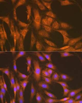 Immunocytochemistry/ Immunofluorescence: UAP1 Antibody (5S7M2) [NBP3-16671]