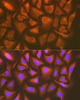 Immunocytochemistry/ Immunofluorescence: UAP1 Antibody (5S7M2) [NBP3-16671]
