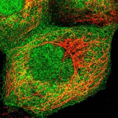 Immunocytochemistry/ Immunofluorescence: UAP1 Antibody [NBP1-89197]