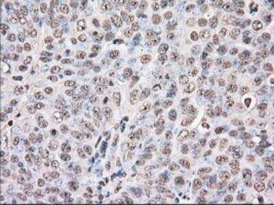 Immunohistochemistry-Paraffin: UAP56 Antibody (OTI2C5) [NBP2-02553]