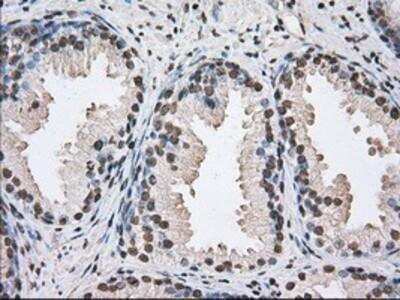 Immunohistochemistry-Paraffin: UAP56 Antibody (OTI2C5) [NBP2-02553]