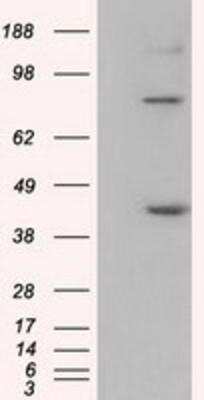 Western Blot: UAP56 Antibody (OTI2C5) [NBP2-02553]