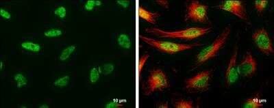 Immunocytochemistry/ Immunofluorescence: UAP56 Antibody [NBP1-31356]
