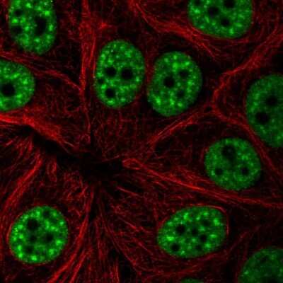 Immunocytochemistry/ Immunofluorescence: UAP56 Antibody [NBP2-58594]