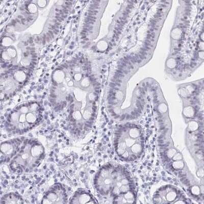 Immunohistochemistry-Paraffin: UAP56 Antibody [NBP2-58594]