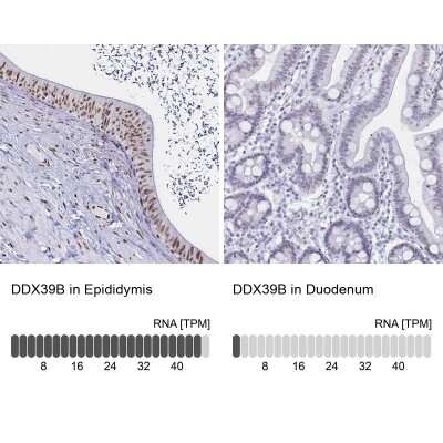 Immunohistochemistry-Paraffin: UAP56 Antibody [NBP2-58594]