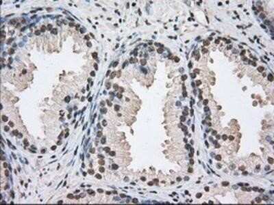 Immunohistochemistry: UAP56 Antibody (OTI2C5) - Azide and BSA Free [NBP2-74727]