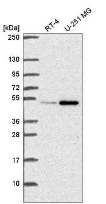 Western Blot: UAP56 Antibody [NBP2-58594]