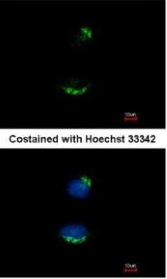 Immunocytochemistry/ Immunofluorescence: UBAC1 Antibody [NBP2-15153]