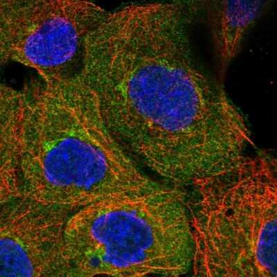 Immunocytochemistry/ Immunofluorescence: UBAP1 Antibody [NBP1-80651]