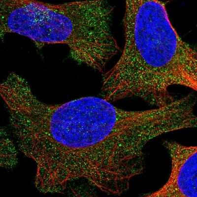 Immunocytochemistry/ Immunofluorescence: UBAP1 Antibody [NBP2-58969]