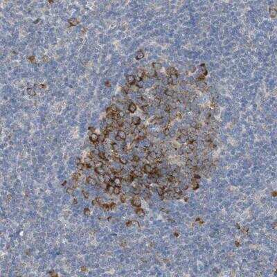 Immunohistochemistry-Paraffin: UBAP2 Antibody [NBP1-90829]