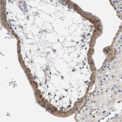 Immunohistochemistry-Paraffin: UBAP2 Antibody [NBP1-90829]