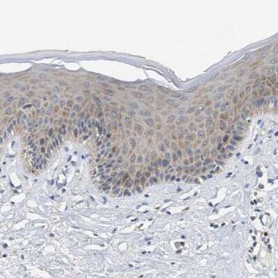 Immunohistochemistry-Paraffin: UBAP2 Antibody [NBP1-90829]