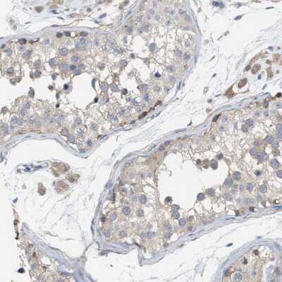 Immunohistochemistry-Paraffin: UBAP2 Antibody [NBP1-90829]