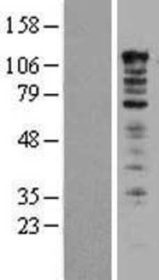 Western Blot: UBAP2L Overexpression Lysate [NBL1-17505]