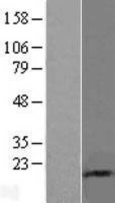 Western Blot: UbcH5a/UBE2D1 Overexpression Lysate [NBL1-17518]