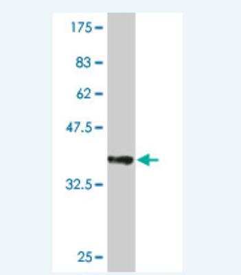 Western Blot: UBE2D4/Ubch5d Antibody (3E1) [H00051619-M01]