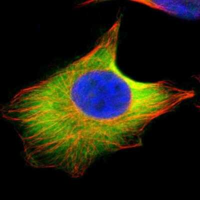 Immunocytochemistry/ Immunofluorescence: UbcH5b/UBE2D2 Antibody [NBP1-81769]