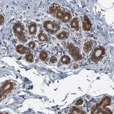 Immunohistochemistry-Paraffin: UbcH5b/UBE2D2 Antibody [NBP1-81769]