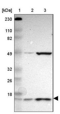Western Blot: UbcH5b/UBE2D2 Antibody [NBP1-81769]