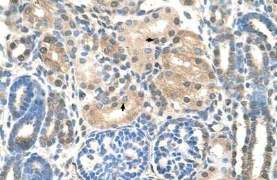 Immunohistochemistry-Paraffin: UBE2E2 Antibody [NBP1-55077]