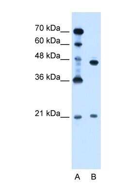 Western Blot: UBE2E2 Antibody [NBP1-55077]