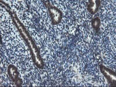 Immunohistochemistry: UBE2E3 Antibody (OTI1B4) [NBP2-46271]