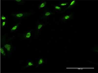 Immunocytochemistry/ Immunofluorescence: UBE2E3 Antibody (3E9) [H00010477-M05]