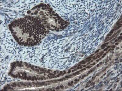 Immunohistochemistry: UBE2E3 Antibody (OTI1B4) - Azide and BSA Free [NBP2-74737]
