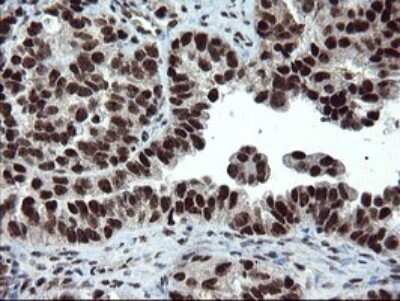 Immunohistochemistry: UBE2E3 Antibody (OTI1B4) - Azide and BSA Free [NBP2-74737]