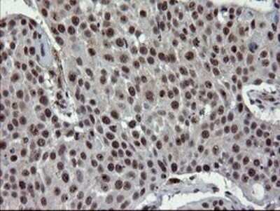 Immunohistochemistry: UBE2E3 Antibody (OTI1B4) - Azide and BSA Free [NBP2-74737]