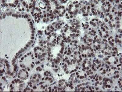 Immunohistochemistry: UBE2E3 Antibody (OTI1B4) - Azide and BSA Free [NBP2-74737]
