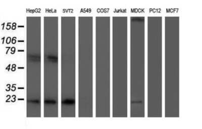 Western Blot: UBE2E3 Antibody (OTI1B4)Azide and BSA Free [NBP2-74737]