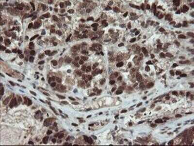 Immunohistochemistry: UBE2E3 Antibody (OTI7E8) - Azide and BSA Free [NBP2-74745]