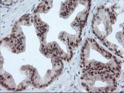 Immunohistochemistry: UBE2E3 Antibody (OTI7E8) - Azide and BSA Free [NBP2-74745]
