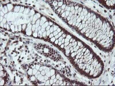 Immunohistochemistry: UBE2E3 Antibody (OTI7E8) - Azide and BSA Free [NBP2-74745]