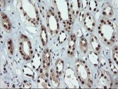 Immunohistochemistry: UBE2E3 Antibody (OTI7E8) - Azide and BSA Free [NBP2-74745]