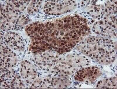 Immunohistochemistry: UBE2E3 Antibody (OTI7E8) - Azide and BSA Free [NBP2-74745]