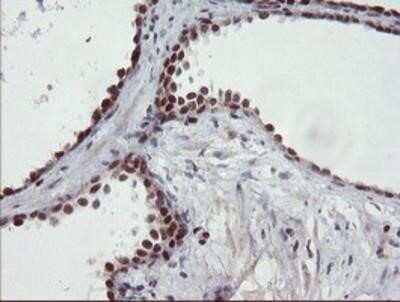 Immunohistochemistry-Paraffin: UBE2E3 Antibody (OTI7E8) [NBP2-03819]