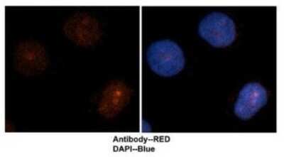 Immunohistochemistry-Paraffin: UBE2F/NCE2 Antibody [NBP1-57602]